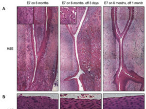 Sections of endocervices from bi-transgenic mice expressing E7 for the indicated time.