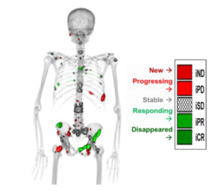 Quantitative Total Bone Imaging (QTBI) uses 18F sodium-fluoride (NaF) PET/CT to automatically identify, segment, and characterize osteoblastic lesions in bone using a variety of imaging features. QTBI allows the ability to co-register multiple scans, using an articulated registration strategy, allowing quantification of individual lesions as they change over time providing both spatial and temporal information. This information allows us to perform PET-directed, CT-guided biopsies in both responding and non-responding lesions allowing each patient to serve as his own control (ongoing clinical trial NCT02677376; PIs: Liu and Jeraj (IR)). This capability also allows us to measure change in total functional burden of disease over time and interlesional response heterogeneity, both of which provide novel clinical trial endpoints to optimize dose, combinations, and sequence of therapies. This tool also serves our discovery initiatives as biopsies of resistant lesions can be readily performed to identify new resistance mechanisms and drug targets.