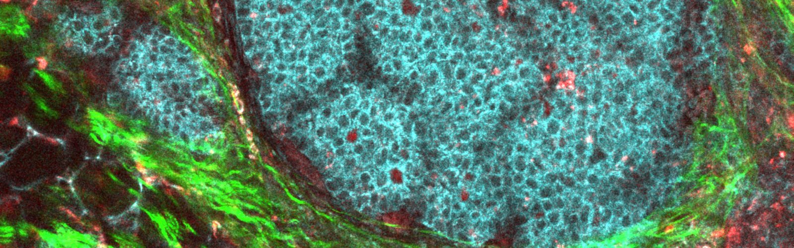 Szulczewski Tumor Microenvironment